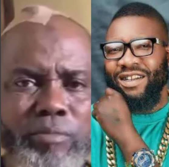 How Koko Zaria Boys Smashed Bottle On My Head  Actor Lewori; Police Vow To Probe Incident  The Gazelle News